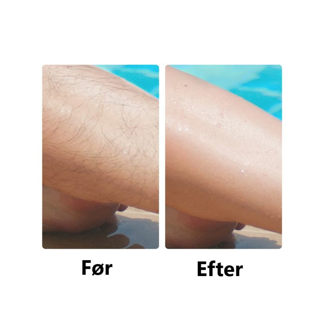 SkySkin - Kristall Hårborttagare